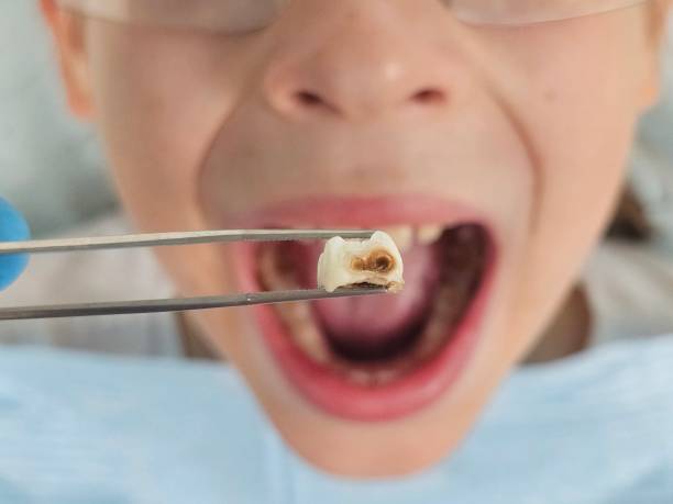 Best Weekend Emergency Dental Services in Harbor Bluffs, FL